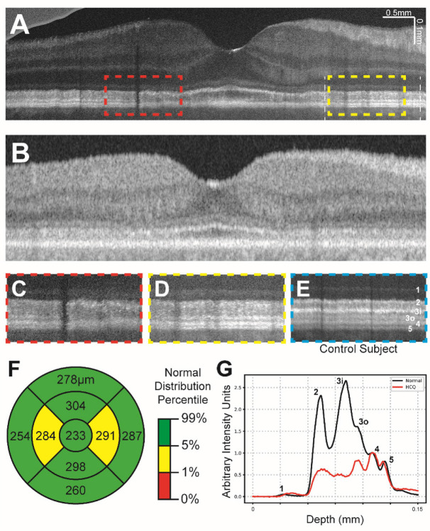 Figure 4: