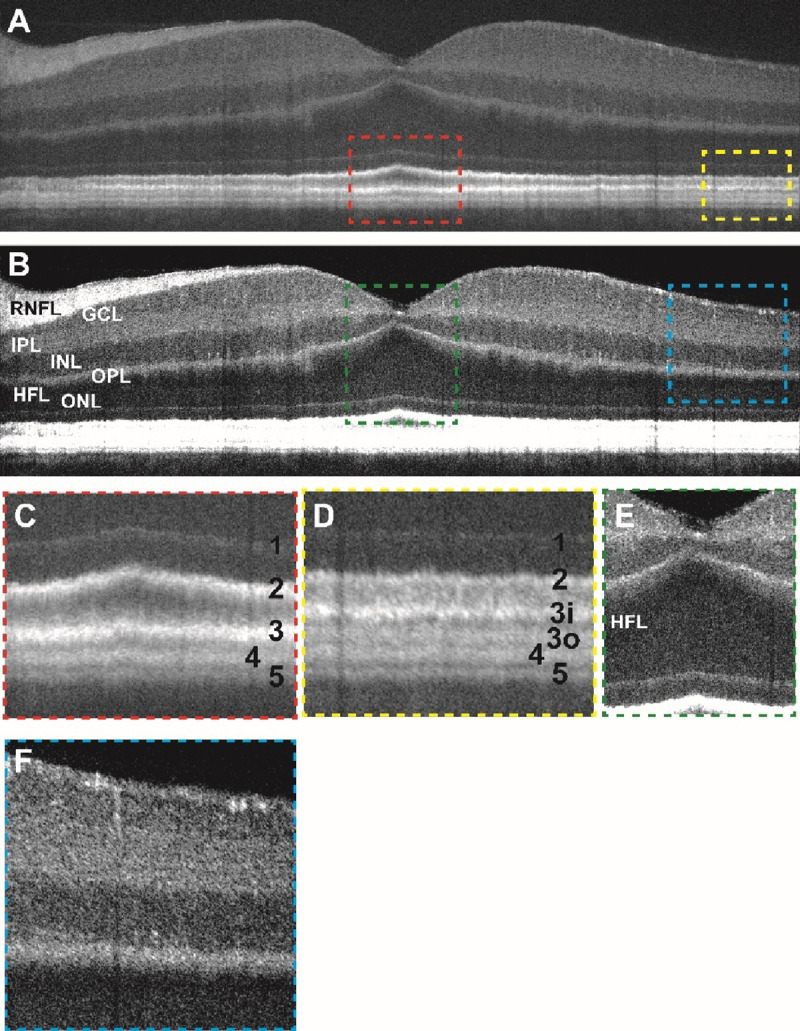 Figure 1: