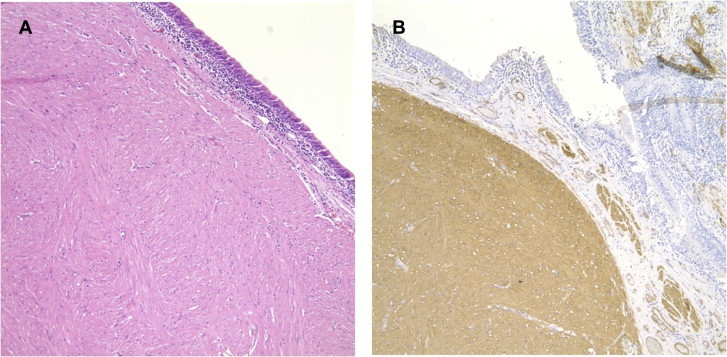 Fig. 4