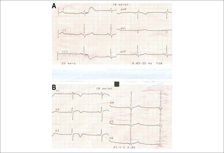 Figure 8 (A and B)