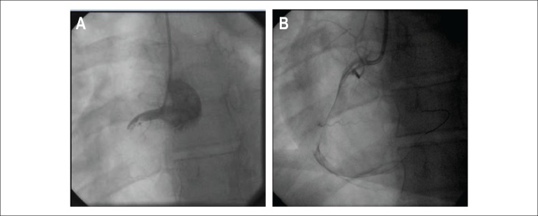 Figure 4 (A and B)