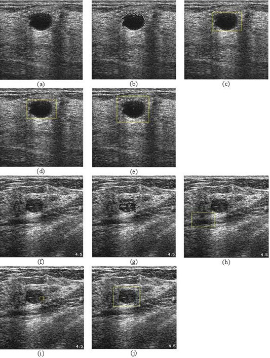 Figure 14