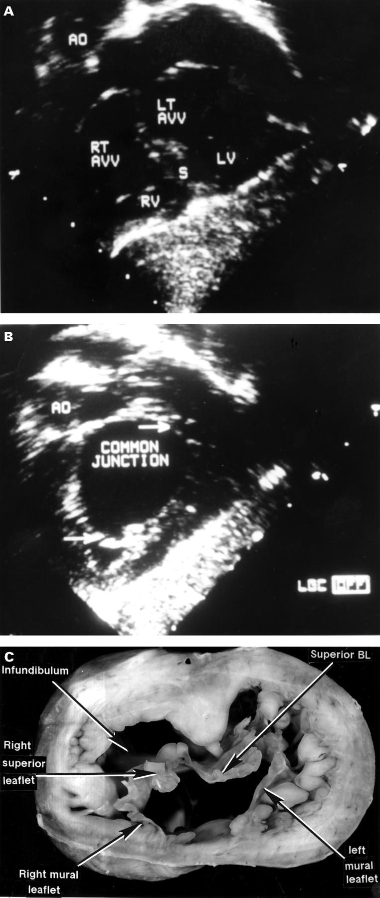 Figure 3  