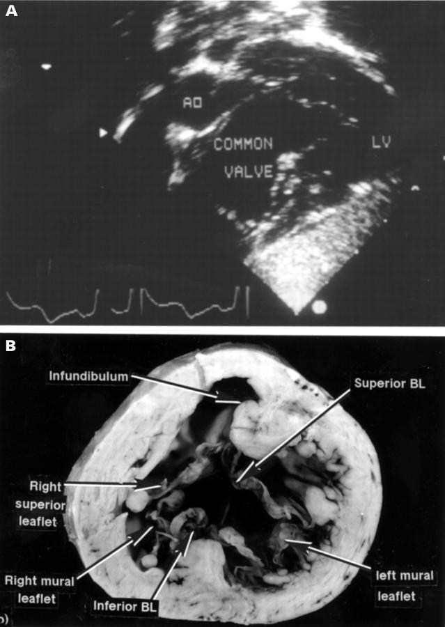 Figure 2  