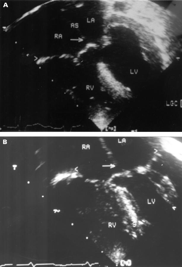 Figure 5  