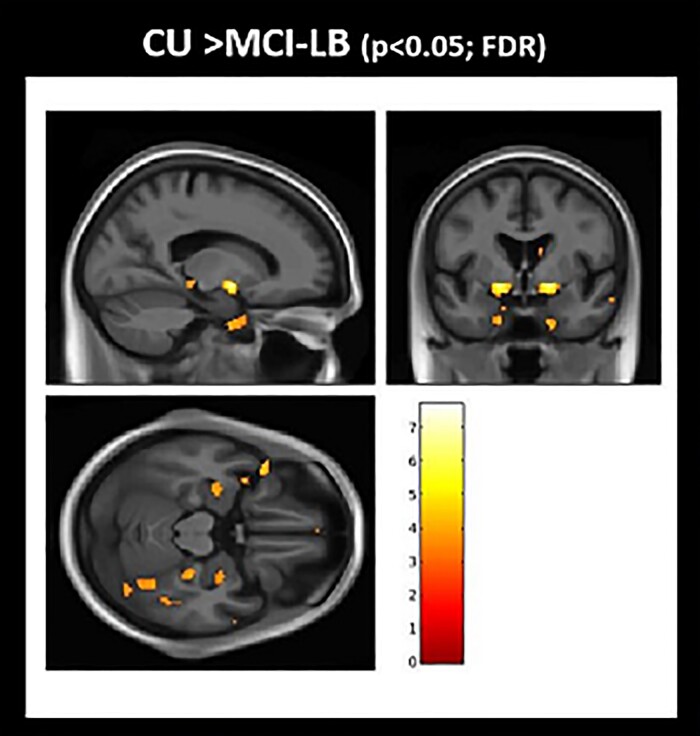 Figure 1