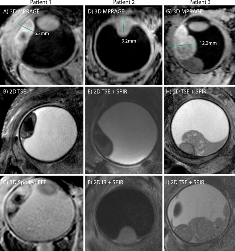 Fig. 4