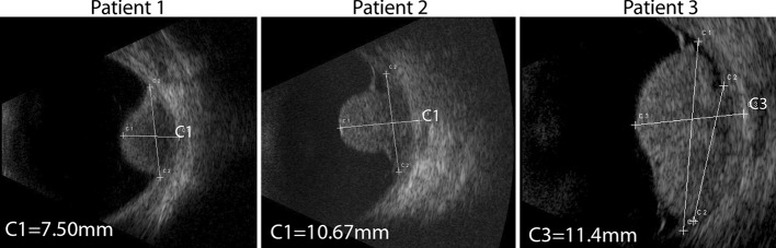 Fig. 1