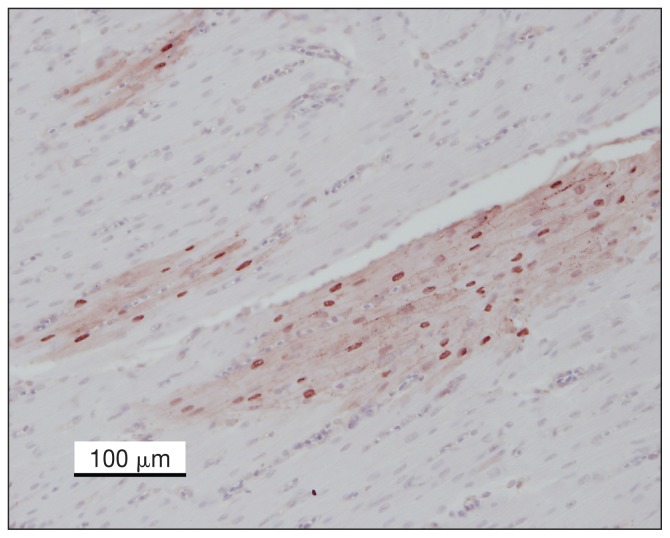 Ontario: Index Case Of Highly Pathogenic Avian Influenza H5n2 In 