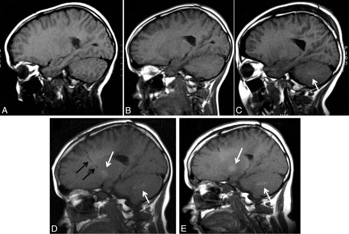 Fig 2.