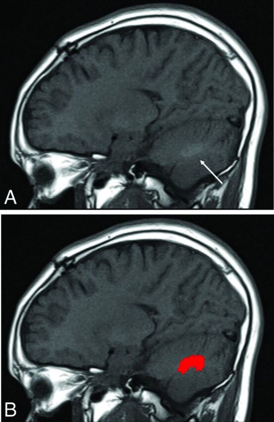 Fig 3.