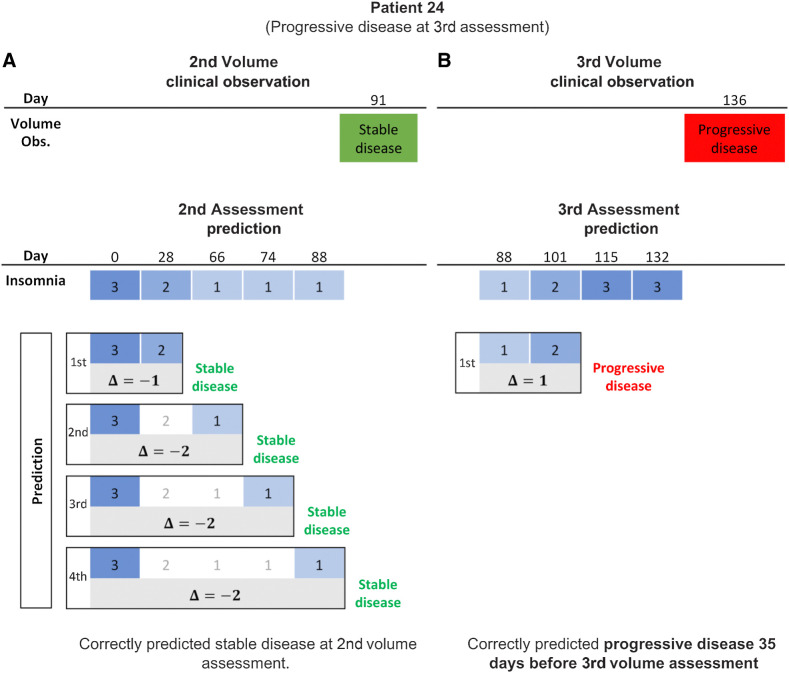 Figure 5. Response prediction for a progressive patient. A, Second assessment response prediction. The clinical volume observation showed stable disease at day 91. Prediction 1 shows that insomnia decreased from 3 to 2 at day 28, such that , correctly predicting stable disease. Insomnia continued to decrease, such that , correctly predicting stable disease for predictions 2 through 4. B, Third assessment response prediction. The clinical volume observation showed progressive disease at day 136. Insomnia increased from 1 to 2 at day 101, correctly predicting progressive disease 35 days before it was assessed via volumetric scan on day 136.