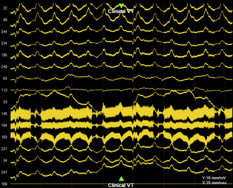 Figure 2