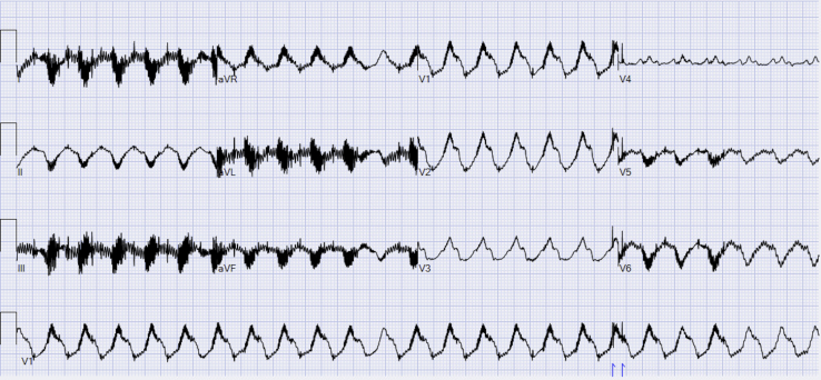 Figure 1