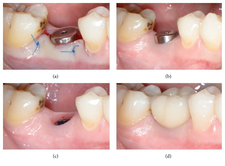 Figure 10