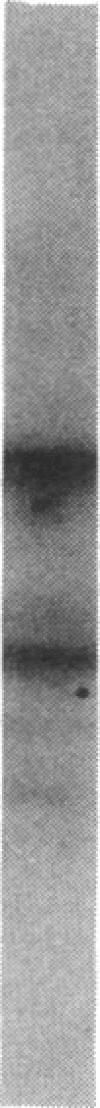 774