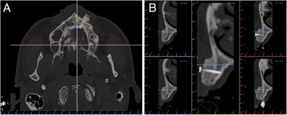 Fig. 4