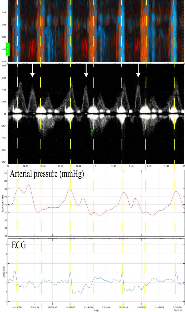 Fig. 2