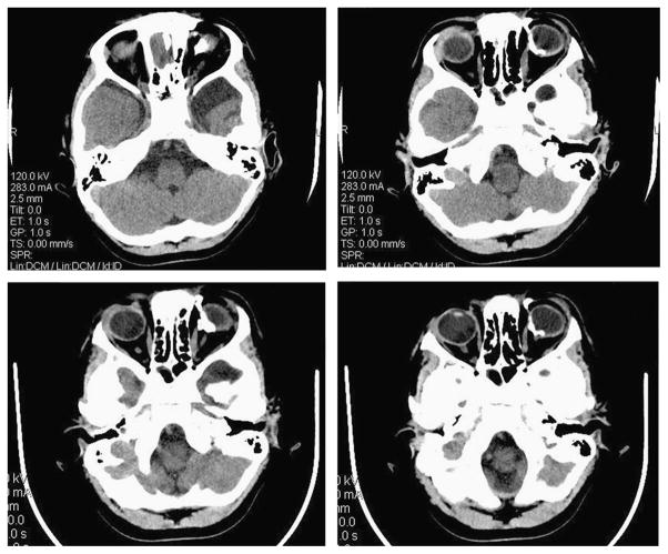 FIGURE 3