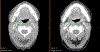 Fig 5(A):