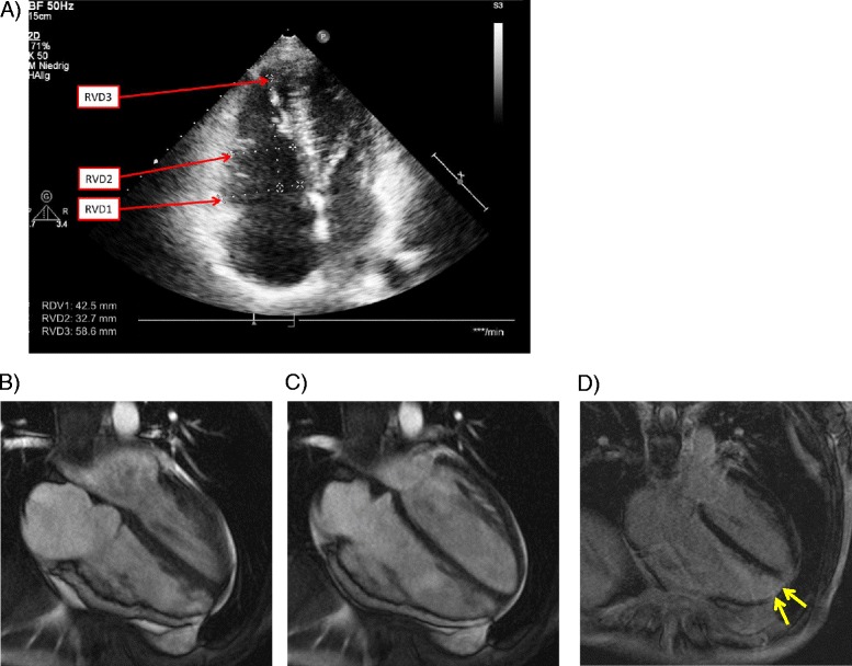 Fig. 2