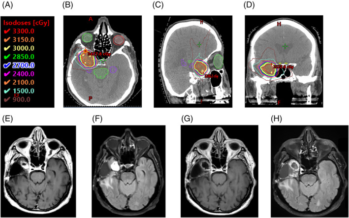 FIGURE 1