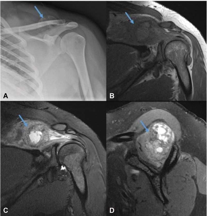 Fig. 13