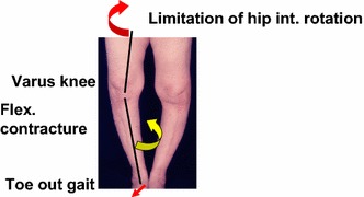 Fig. 17