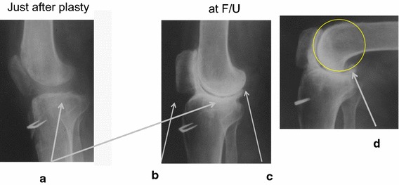 Fig. 5