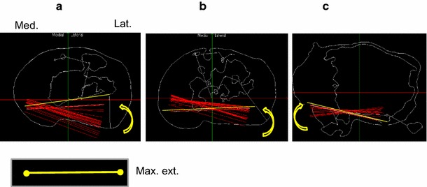 Fig. 16