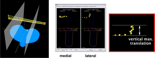 Fig. 14