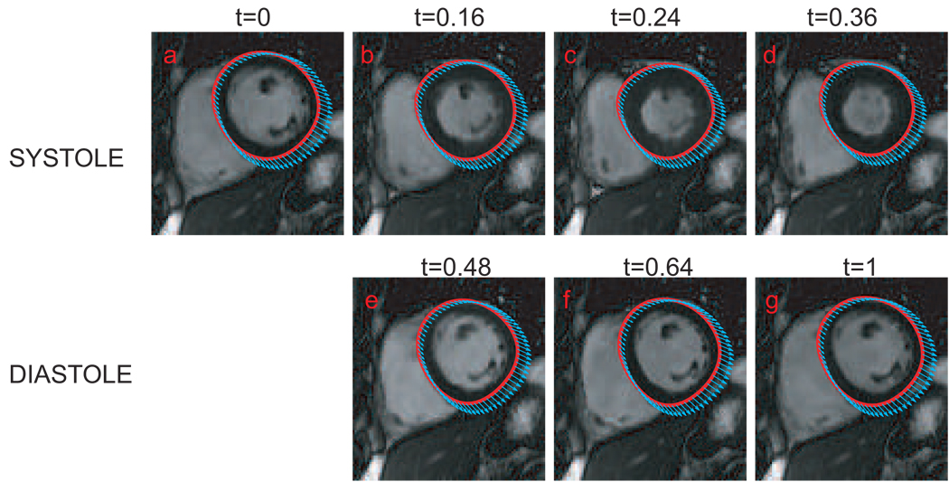 FIG. 3