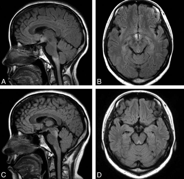 Fig 3.