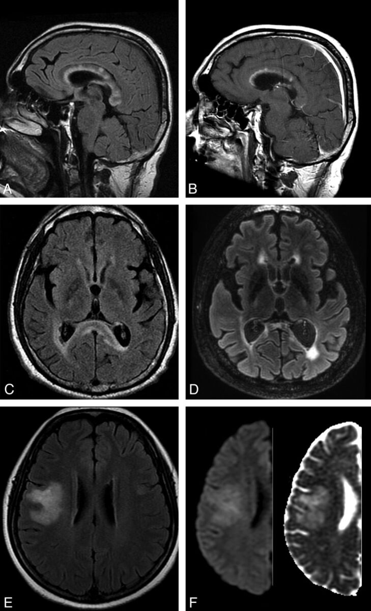 Fig 5.