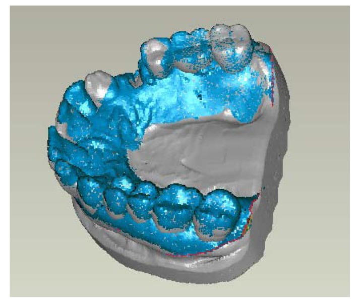 Fig. (2)