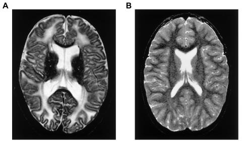 Figure  1