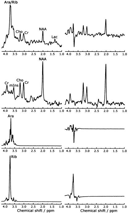 Figure  2