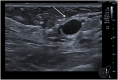 Figure 6