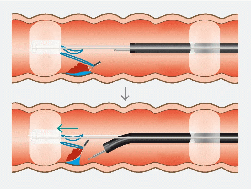 Fig. 3