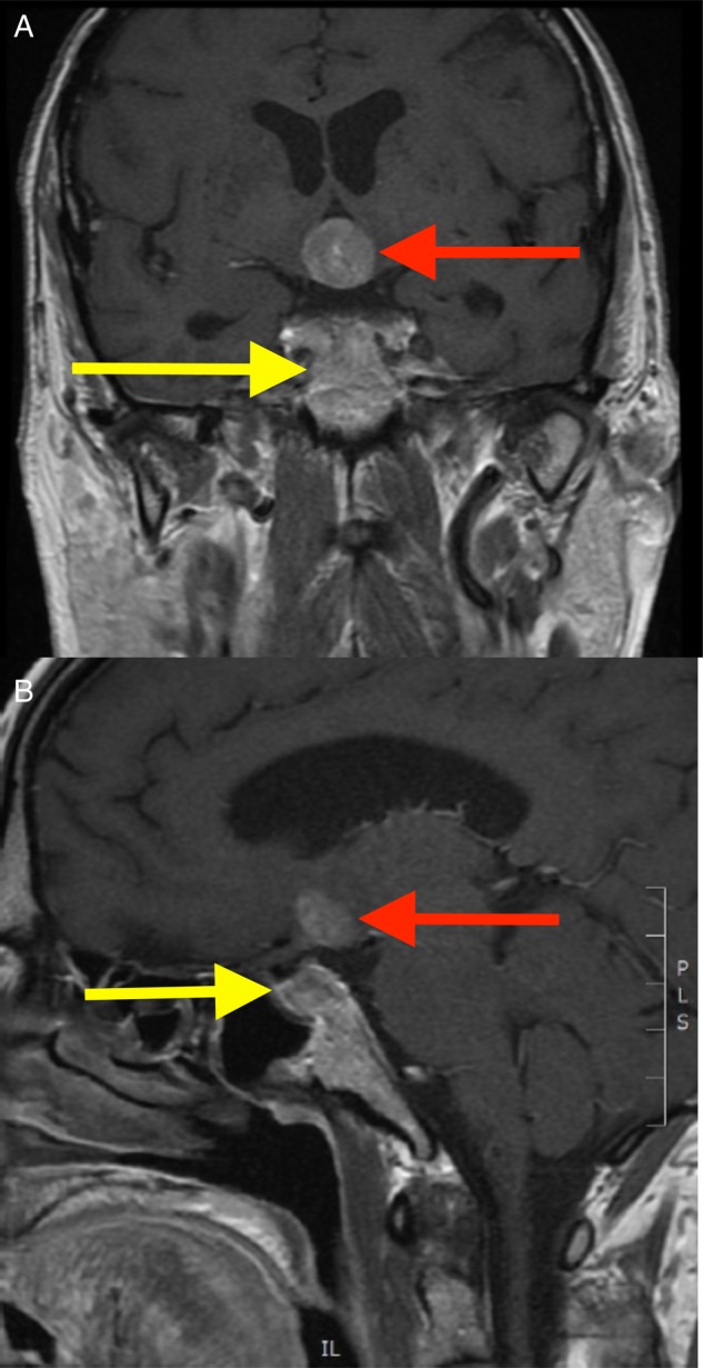 Figure 2: