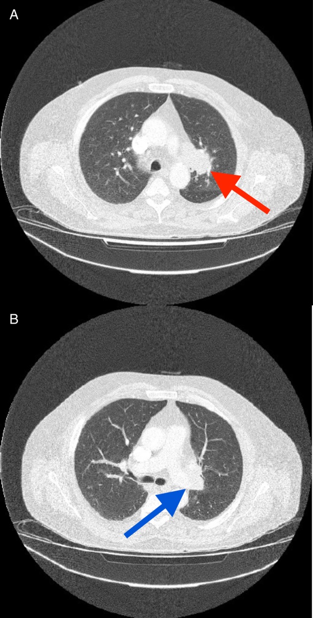 Figure 4: