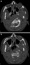 Fig. 5