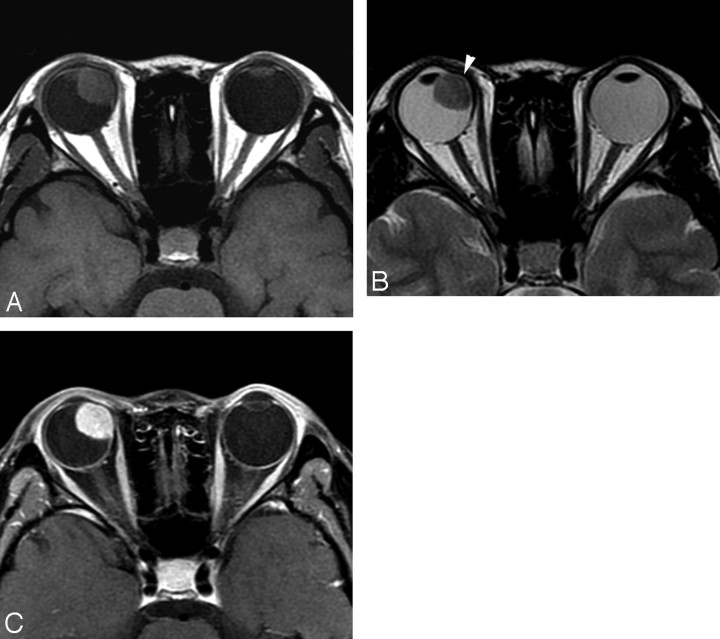 Fig 1.