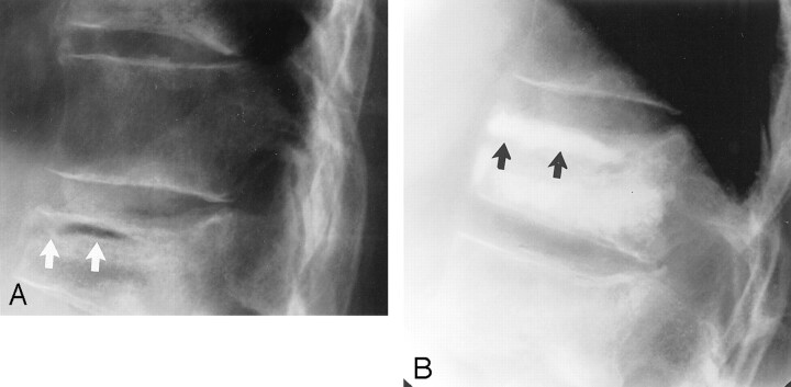 Fig 3.