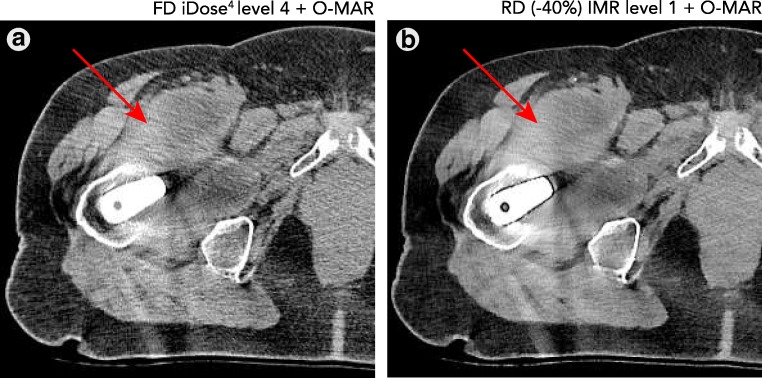 Fig. 10