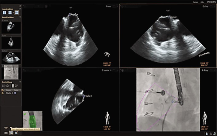 Figure 1: