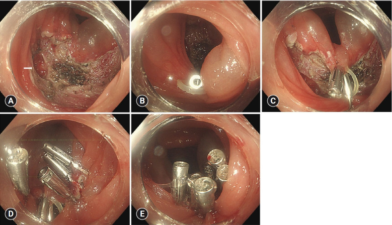 Fig. 7.