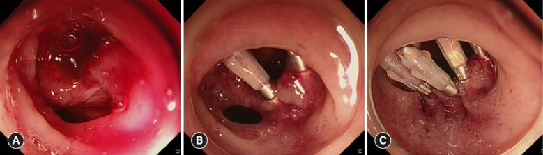 Fig. 3.