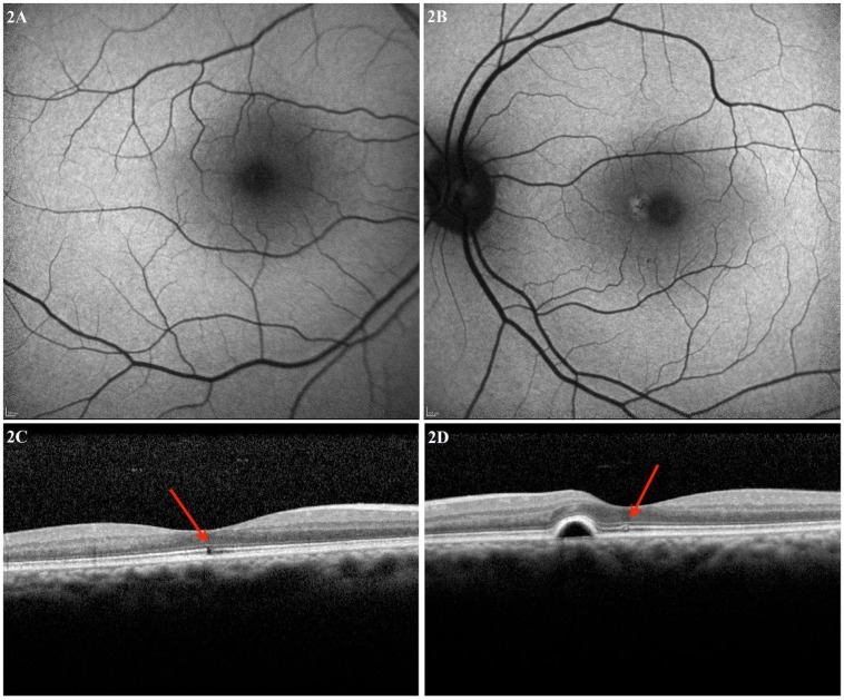 Fig. (2)