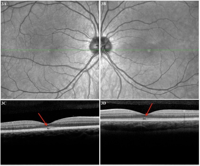 Fig. (3)